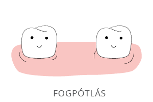 fogpotlas
